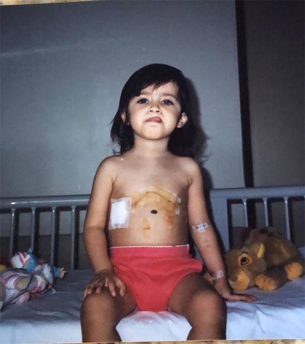 Jéssica Costa mostrou foto da infância após realizar cirurgia cardíaca (Foto: Reprodução/Instagram)