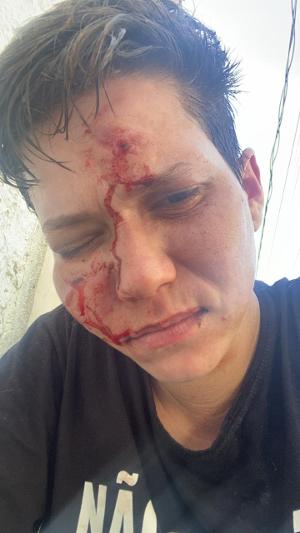 Karol Eller, amiga íntima da família Bolsonaro, foi brutalmente agredida. Foto: Reprodução 