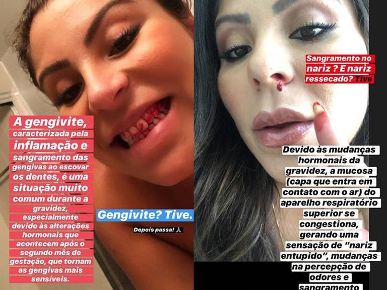 Andressa Ferreira enfrentou problemas com sangramento durante a gravidez (Foto: Reprodução/ Instagram)